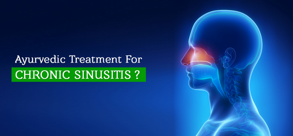 chronic sinusitis